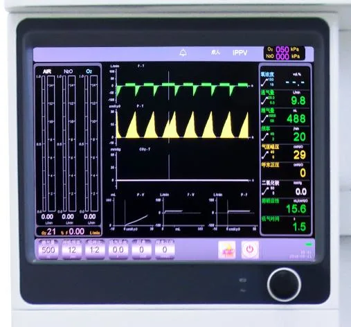 Operating Room Anesthesia System Anesthesiologist Equipment